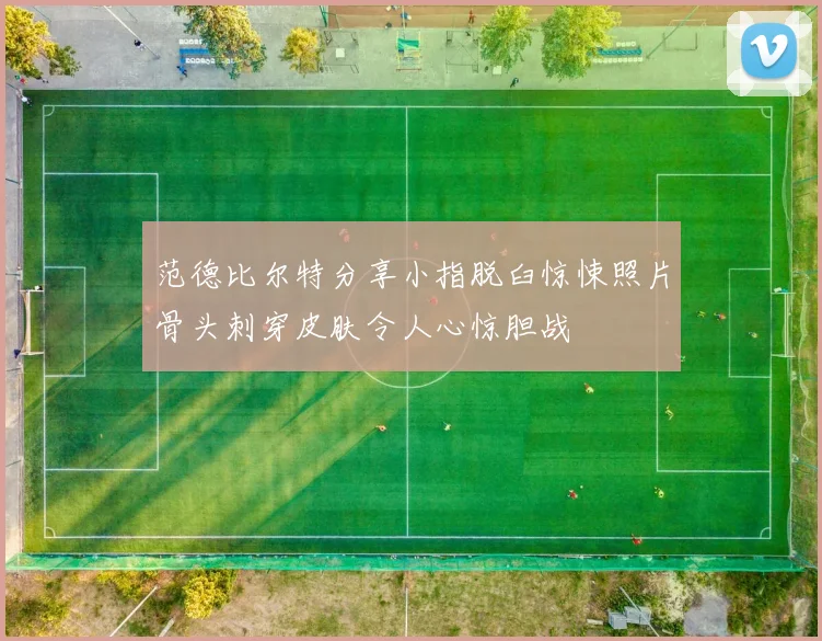 范德比尔特分享小指脱臼惊悚照片骨头刺穿皮肤令人心惊胆战